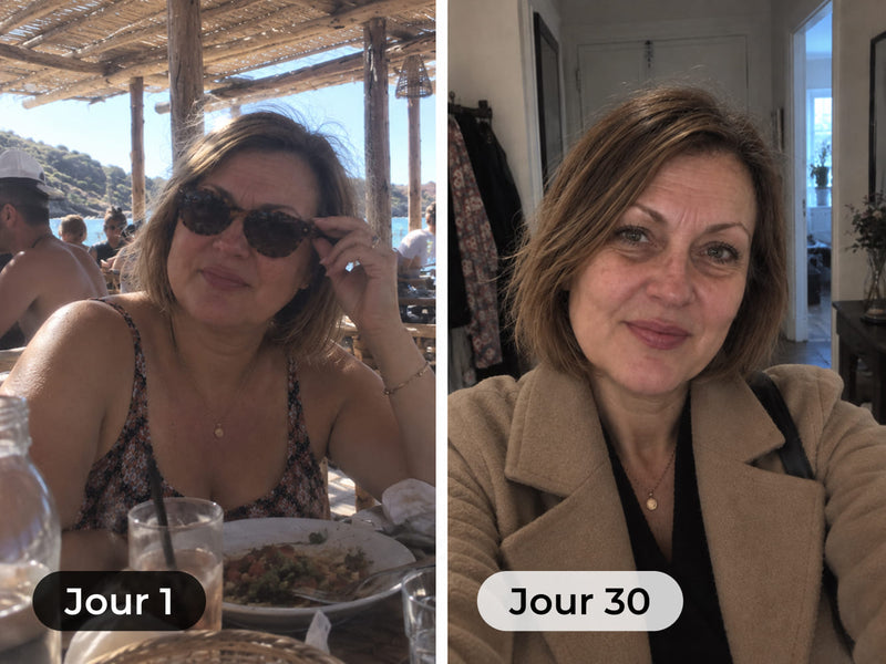 Foto del prima e dopo di una cliente