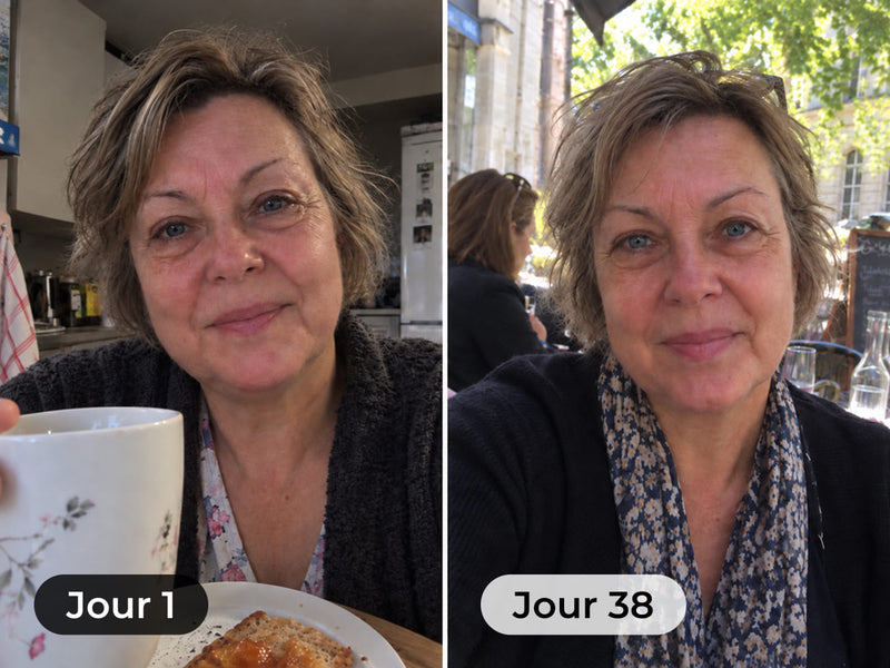 Foto del prima e dopo di una cliente